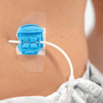 Dispozitiv pentru fixarea cateterelor FlexGrip Universal 5-11 Fr